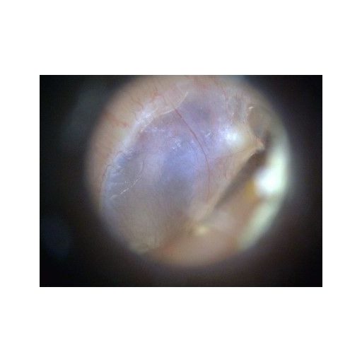 Digital-Otoskop EarScope Pro MEDL4E