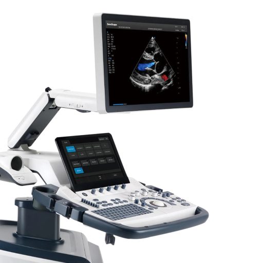 SonoScape S60 ultrasound device