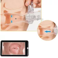   Mini videó kolposzkóp egyszerhasználatos hüvelytükörhöz