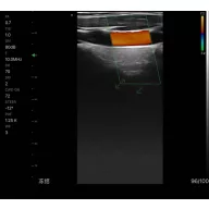   CONTEC CMS 1600B VET dwusondowy system diagnostyki ultrasonograficznej z kolorowym Dopplerem 32 kanałowa sonda akumulatorowa wypukła i liniowa