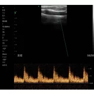   CONTEC CMS 1600B VET dwusondowy system diagnostyki ultrasonograficznej z kolorowym Dopplerem 32 kanałowa sonda akumulatorowa wypukła i liniowa