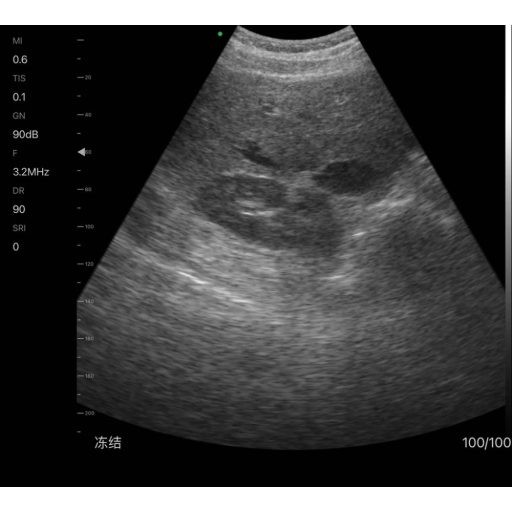 CONTEC CMS 1600B dwusondowy system diagnostyki ultrasonograficznej z kolorowym Dopplerem 32 kanałowa sonda akumulatorowa wypukła i liniowa