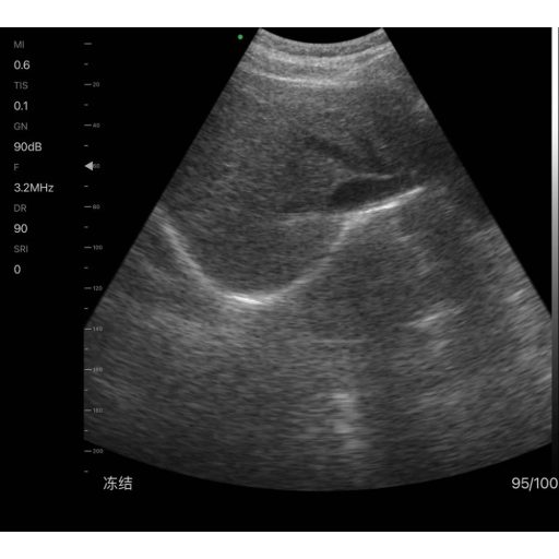 CONTEC CMS 1600B dwusondowy system diagnostyki ultrasonograficznej z kolorowym Dopplerem 32 kanałowa sonda akumulatorowa wypukła i liniowa