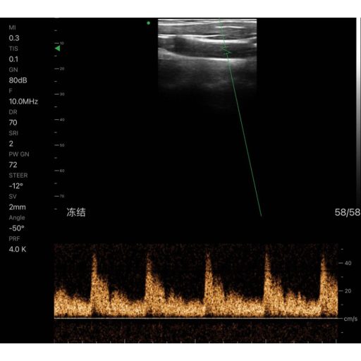 CONTEC CMS 1600B dwusondowy system diagnostyki ultrasonograficznej z kolorowym Dopplerem 32 kanałowa sonda akumulatorowa wypukła i liniowa