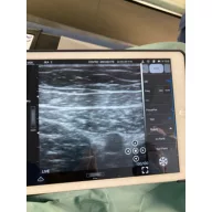   CONTEC CMS 1600B dwusondowy system diagnostyki ultrasonograficznej z kolorowym Dopplerem 32 kanałowa sonda akumulatorowa wypukła i liniowa
