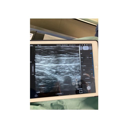 CONTEC CMS 1600B dwusondowy system diagnostyki ultrasonograficznej z kolorowym Dopplerem 32 kanałowa sonda akumulatorowa wypukła i liniowa