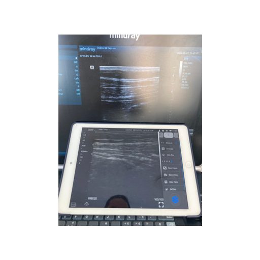 CONTEC CMS 1600B dwusondowy system diagnostyki ultrasonograficznej z kolorowym Dopplerem 32 kanałowa sonda akumulatorowa wypukła i liniowa