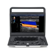   Sonoscape E2 Ultraschallsystem mit konvexer und linearer Sondev