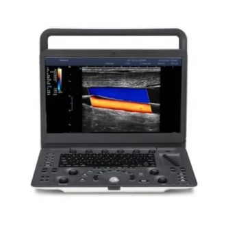 Sonoscape E2 ultrasound system with convex and linear probe