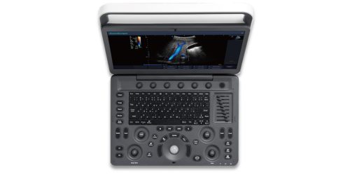 System ultrasonograficzny Sonoscape E2 z sondą wypukłą i liniową