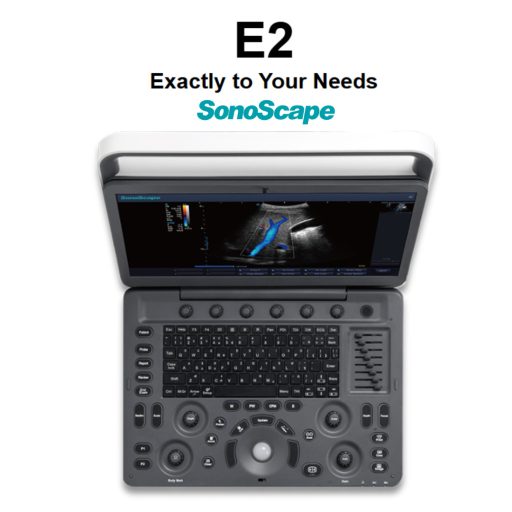 Sonoscape E2 Ultraschallsystem mit konvexer und linearer Sondev