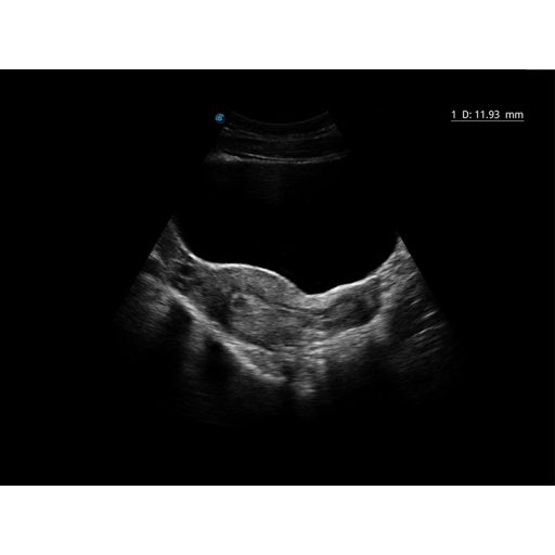 Sonoscape E2 Ultraschallsystem mit konvexer und linearer Sondev