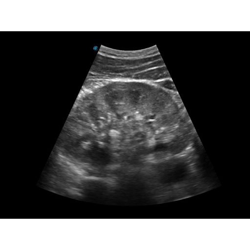 Sonoscape E2 Ultraschallsystem mit konvexer und linearer Sondev