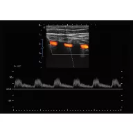   Sonoscape E2 Ultraschallsystem mit konvexer und linearer Sondev