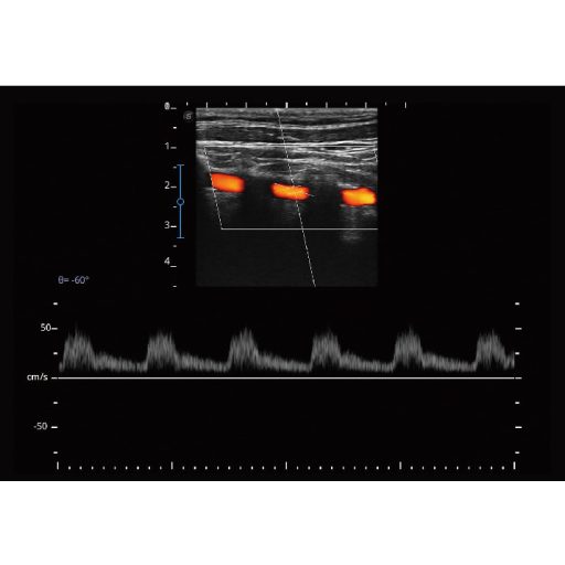 Sonoscape E2 Ultraschallsystem mit konvexer und linearer Sondev