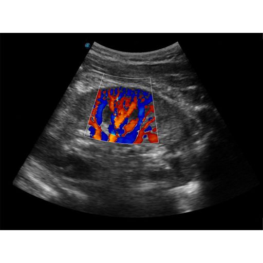 Sonoscape E2 Ultraschallsystem mit konvexer und linearer Sondev