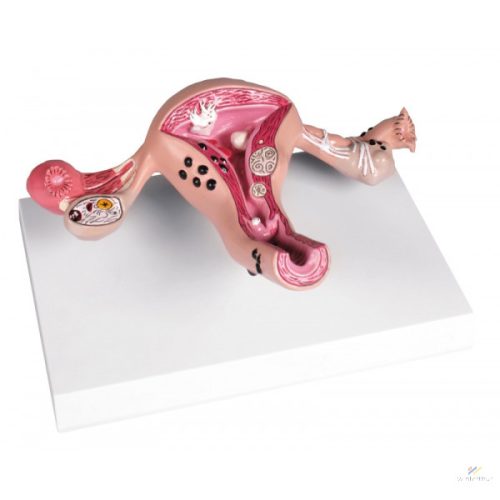 Méh modell betegségekkel