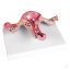 Uterus model with diseases