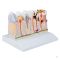 Dental model 4x