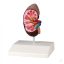 Kidney model 