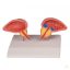Prostate model, 2 parts