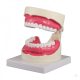 Oral hygiene model, 1,5x life size