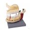Upper and lower jaw model