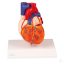 Heart bypass model