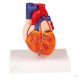 Heart bypass model
