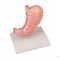 Life-size stomach model, 2 parts