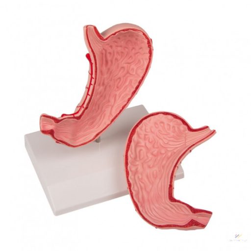 Life-size stomach model, 2 parts
