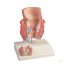 Hemorrhoids model