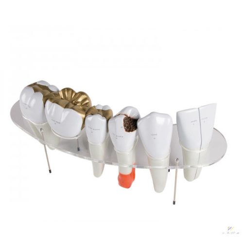 Dental morphology series, 7 part model