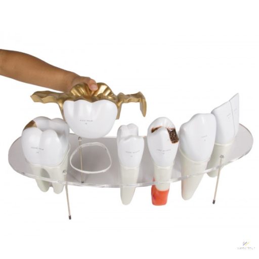 Dental morphology series, 7 part model