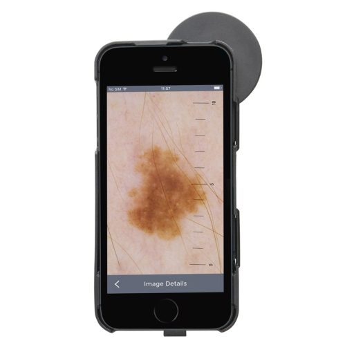 Heine iC1 Dermatoskop für iPhone 6/6S