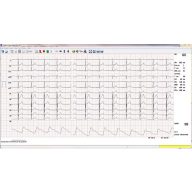 CARDIAX ECG load module
