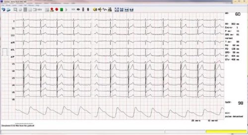 CARDIAX EKG terheléses modul