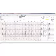 CARDIAX ECG load module