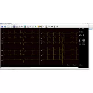 CARDIAX USB, 12 channel computer ECG device