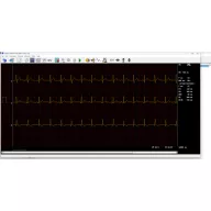 CARDIAX USB, 12 channel computer ECG device