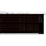 CARDIAX WiFi / USB ECG device