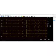 CARDIAX WiFi / USB ECG device