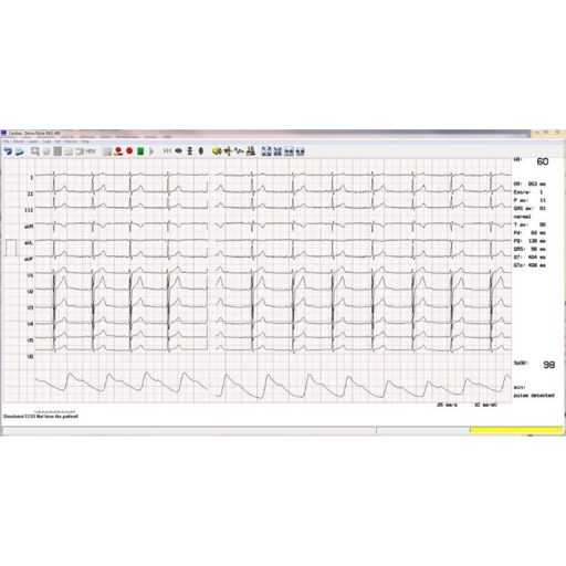 Terheléses EKG rendszer, vezeték nélküli Cardiax EKG-val, Sanabike 1000 beépített vérnyomásmérős kerékpár ergométerrel
