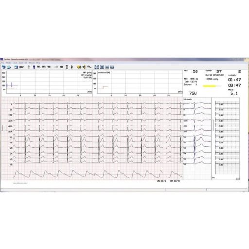 Terheléses EKG rendszer, vezeték nélküli Cardiax EKG-val, Sanabike 1000 beépített vérnyomásmérős kerékpár ergométerrel