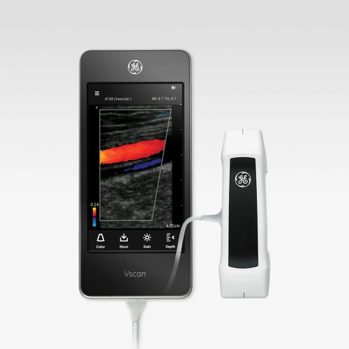 GE Vscan Extend Ultrasound