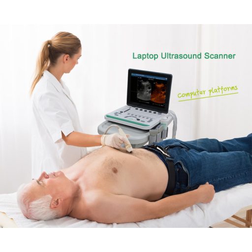 SonoStar SS-8 ultrasound with 15" LED display