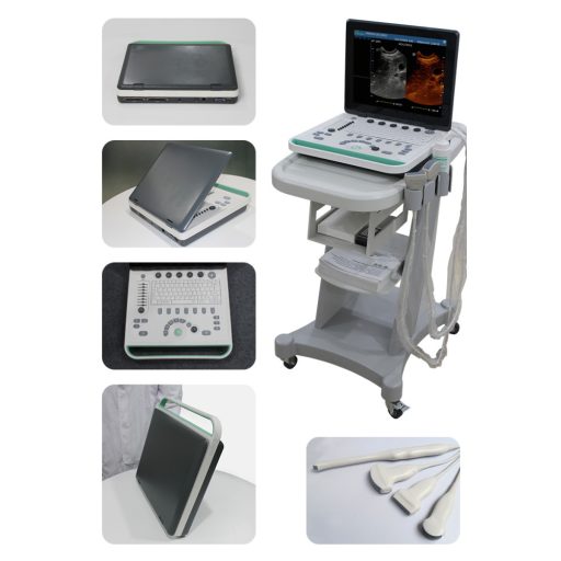 SonoStar SS-8 ultrasound with 15" LED display