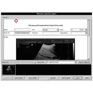 SonoStar SS-8-Ultraschall mit 15"-LED-Display
