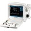 EDAN DUS60 portable ultrasound unit with convex head