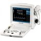 EDAN DUS60 portable ultrasound unit with convex head